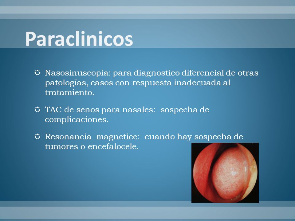 Paraclinicos Nasosinuscopia: para diagnostico diferencial de otras patologías, casos con respuesta inadecuada al tratamiento.