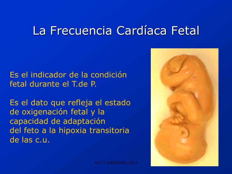 La Frecuencia Cardíaca Fetal