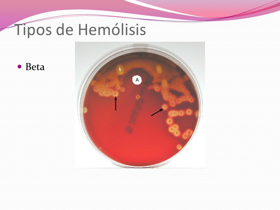 Tipos de Hemólisis Beta