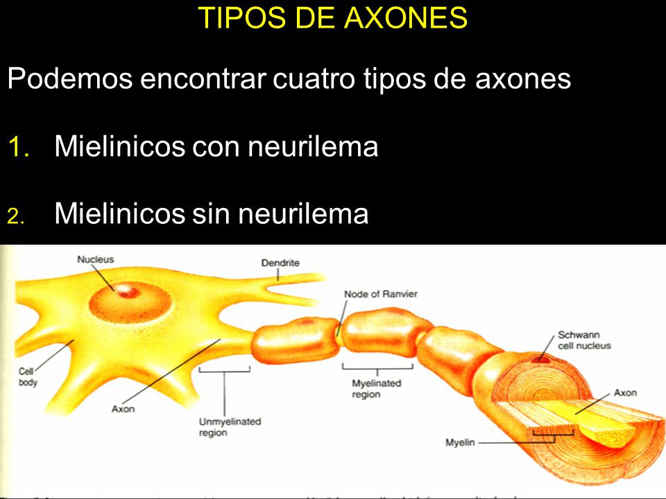 Podemos encontrar cuatro tipos de axones Mielinicos con neurilema