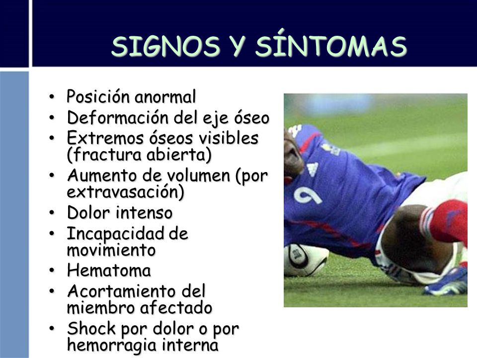 SIGNOS Y SÍNTOMAS Posición anormal Deformación del eje óseo