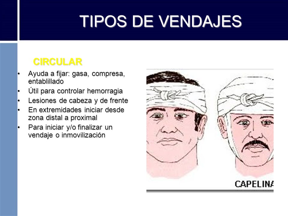 TIPOS DE VENDAJES CIRCULAR Ayuda a fijar: gasa, compresa, entablillado