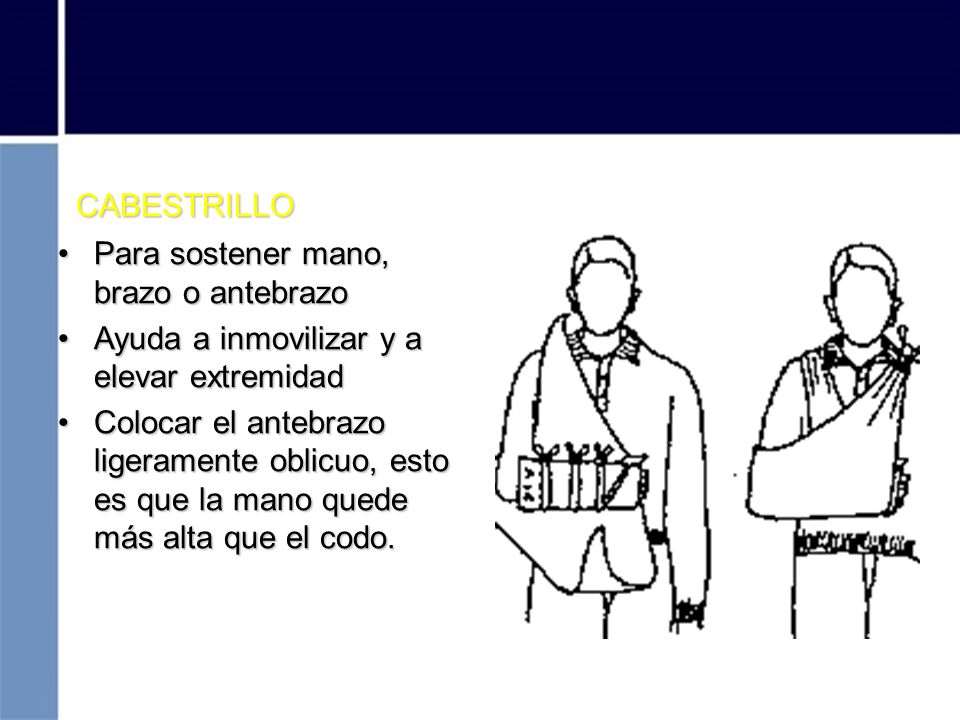 CABESTRILLO Para sostener mano, brazo o antebrazo. Ayuda a inmovilizar y a elevar extremidad.