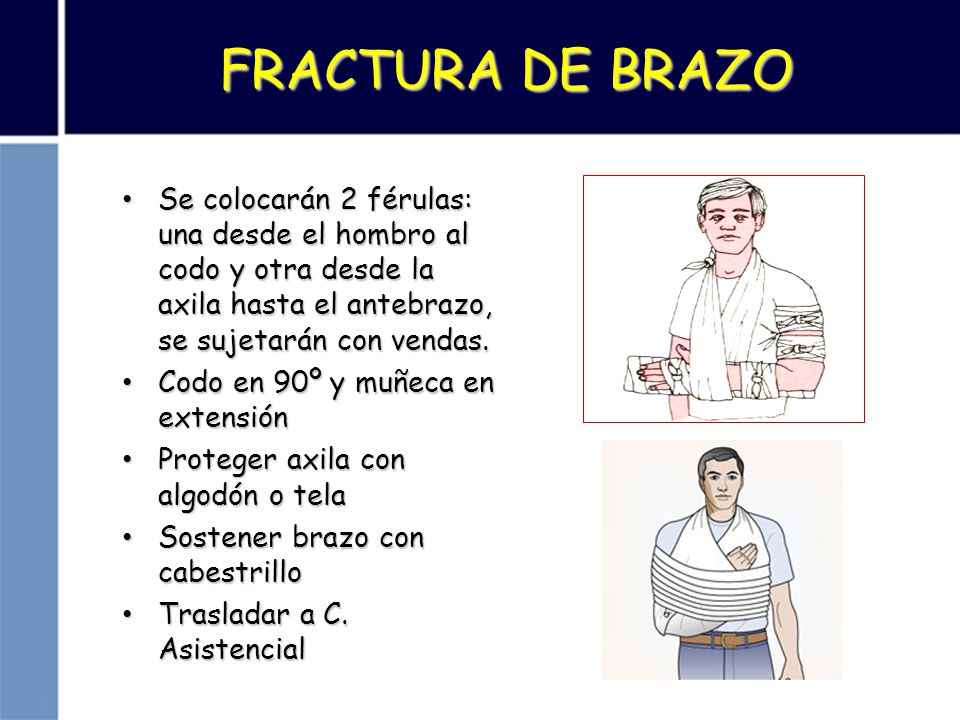 FRACTURA DE BRAZO Se colocarán 2 férulas: una desde el hombro al codo y otra desde la axila hasta el antebrazo, se sujetarán con vendas.