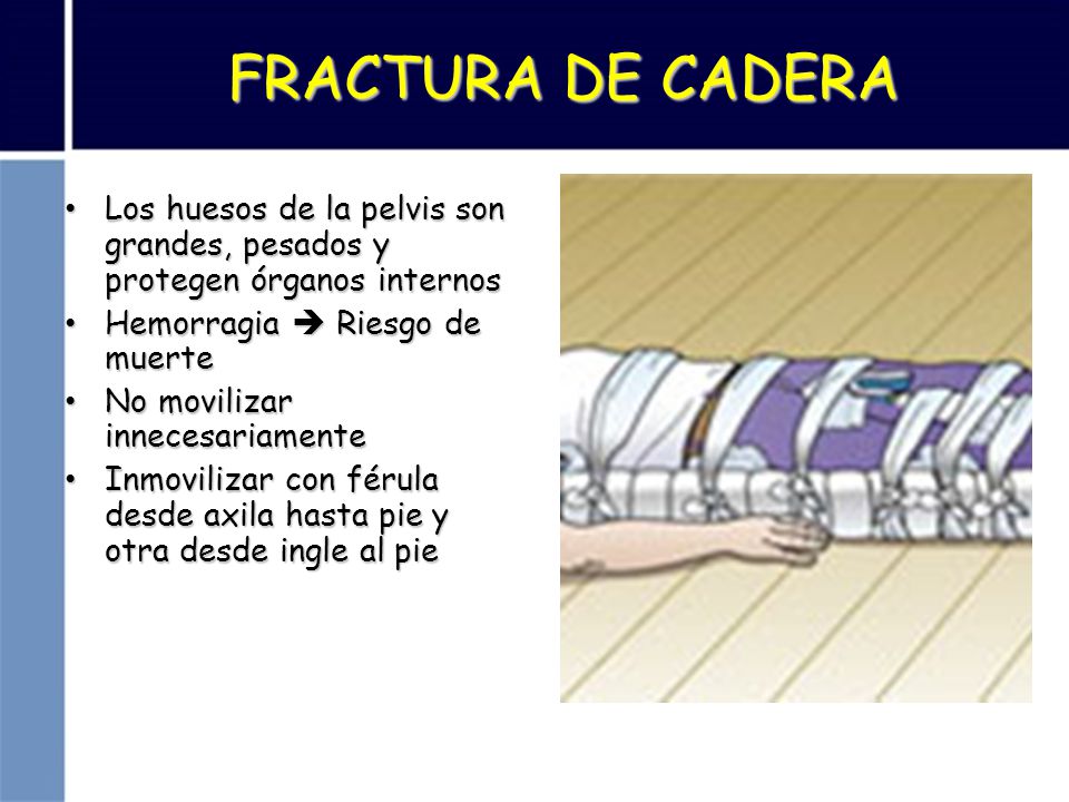 FRACTURA DE CADERA Los huesos de la pelvis son grandes, pesados y protegen órganos internos. Hemorragia  Riesgo de muerte.