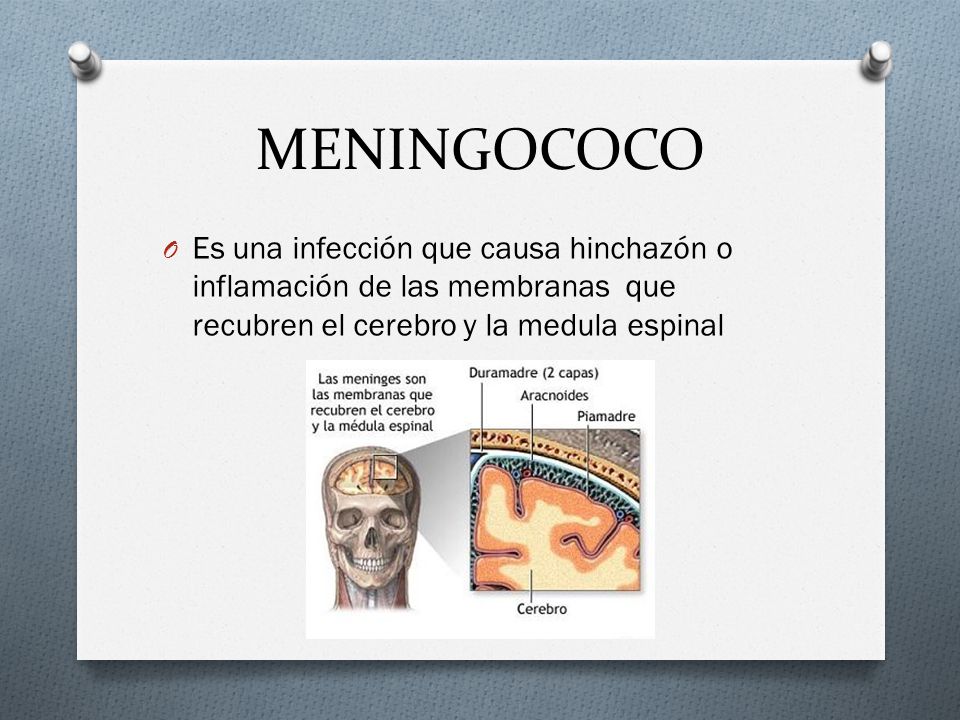 MENINGOCOCO Es una infección que causa hinchazón o inflamación de las membranas que recubren el cerebro y la medula espinal.