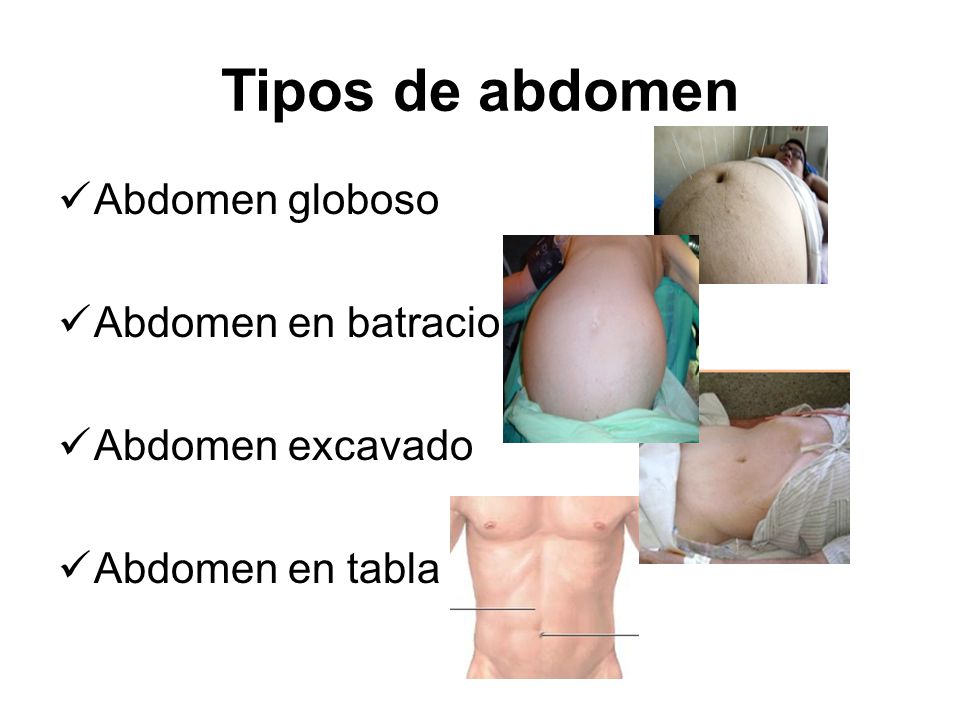 Tipos de abdomen Abdomen globoso Abdomen en batracio Abdomen excavado