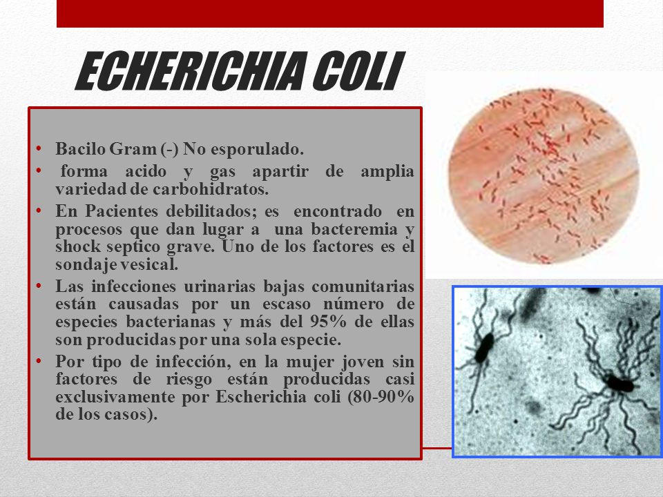 ECHERICHIA COLI ESCHERICHIA COLI Bacilo Gram (-) No esporulado.