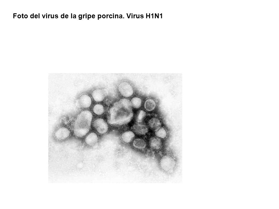 Foto del virus de la gripe porcina. Virus H1N1
