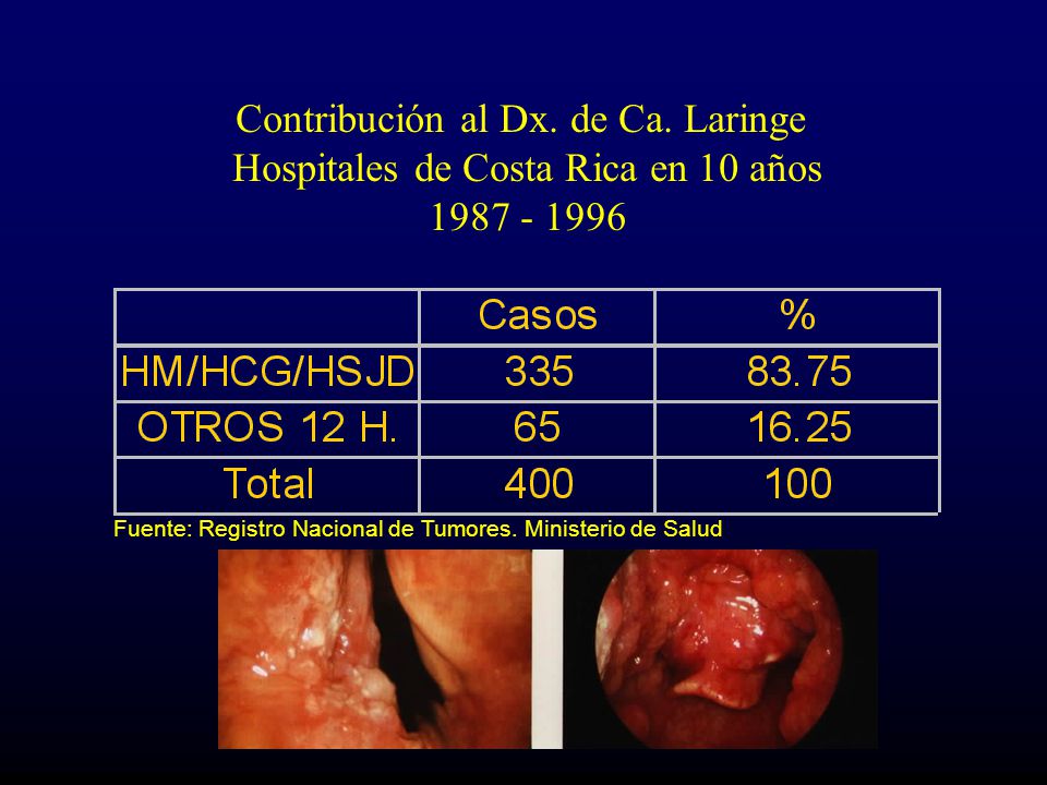 Contribución al Dx. de Ca. Laringe Hospitales de Costa Rica en 10 años