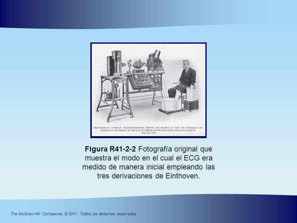Figura R Fotografía original que muestra el modo en el cual el ECG era medido de manera inicial empleando las tres derivaciones de Einthoven.