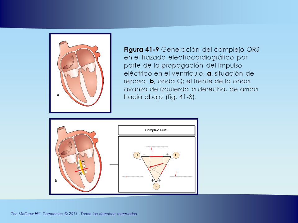 Figura 41-9 Generación del complejo QRS en el trazado electrocardiográfico por parte de la propagación del impulso
