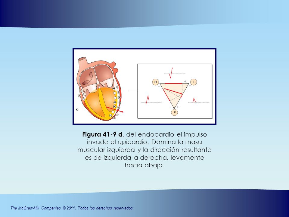 Figura 41-9 d, del endocardio el impulso invade el epicardio