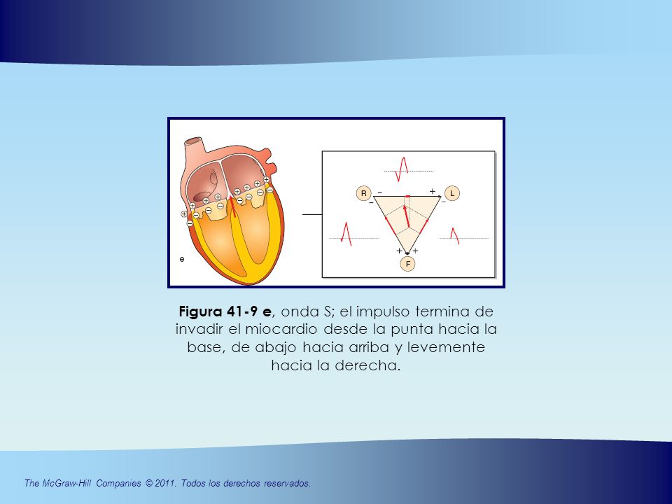 Figura 41-9 e, onda S; el impulso termina de invadir el miocardio desde la punta hacia la base, de abajo hacia arriba y levemente hacia la derecha.