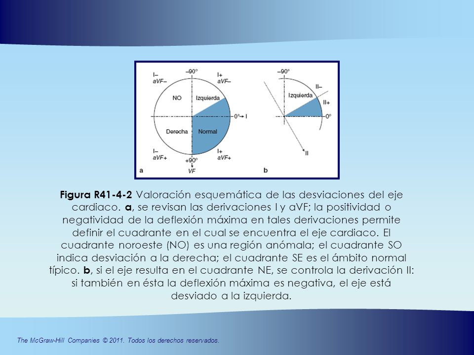 Figura R Valoración esquemática de las desviaciones del eje
