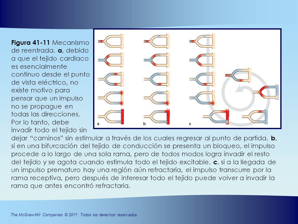 Figura Mecanismo de reentrada. a, debido a que el tejido cardiaco
