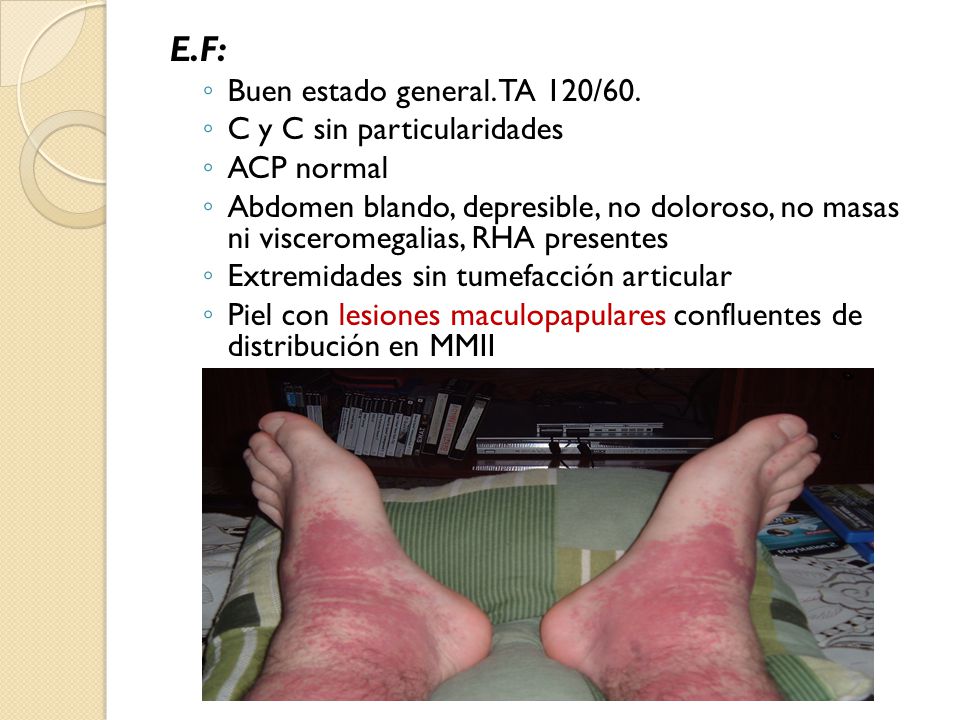 E.F: Buen estado general. TA 120/60. C y C sin particularidades