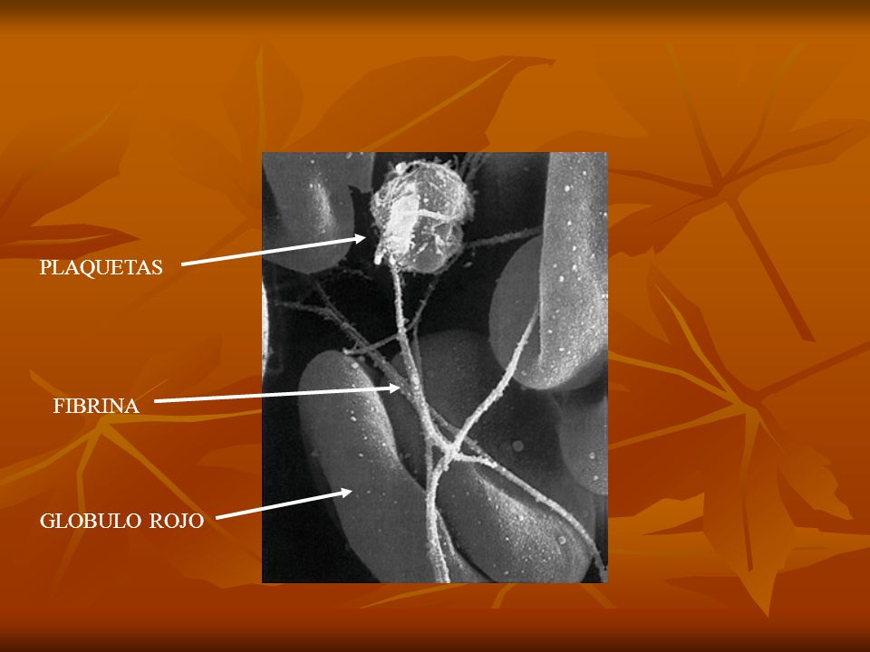 PLAQUETAS FIBRINA GLOBULO ROJO