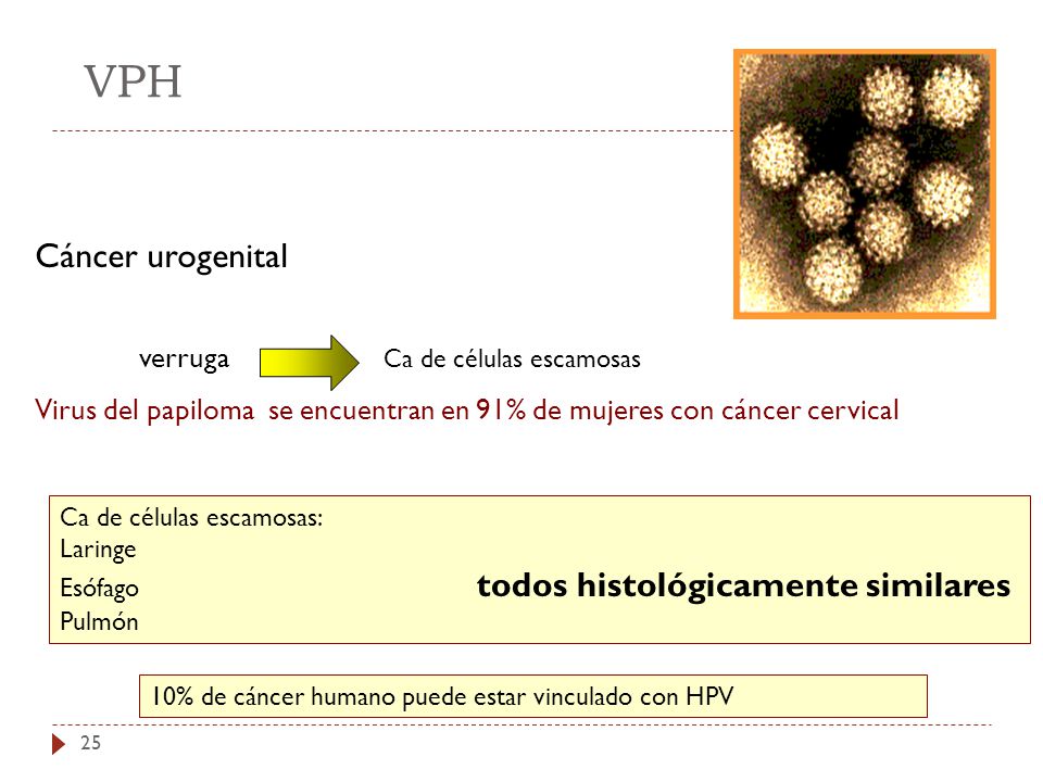 VPH Cáncer urogenital. verruga Ca de células escamosas. Virus del papiloma se encuentran en 91% de mujeres con cáncer cervical.