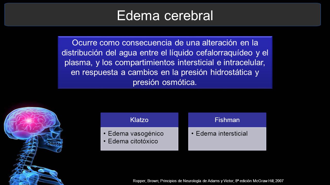 Edema cerebral