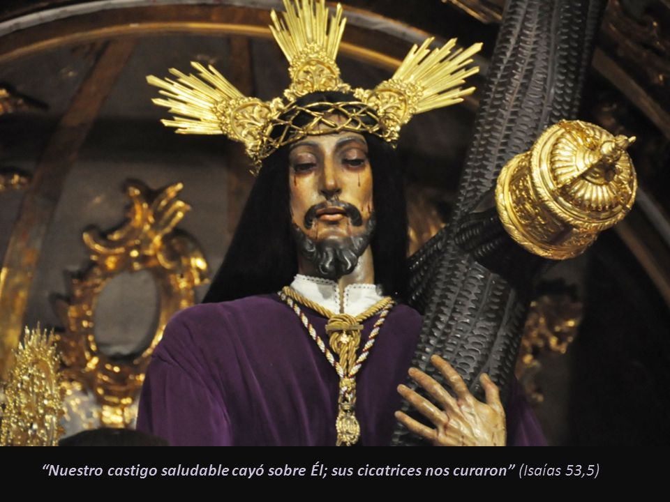 Nuestro castigo saludable cayó sobre Él; sus cicatrices nos curaron (Isaías 53,5)