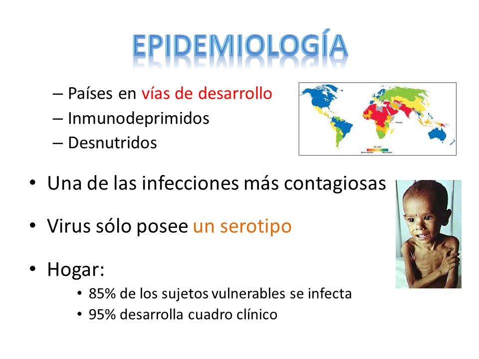 Epidemiología Una de las infecciones más contagiosas