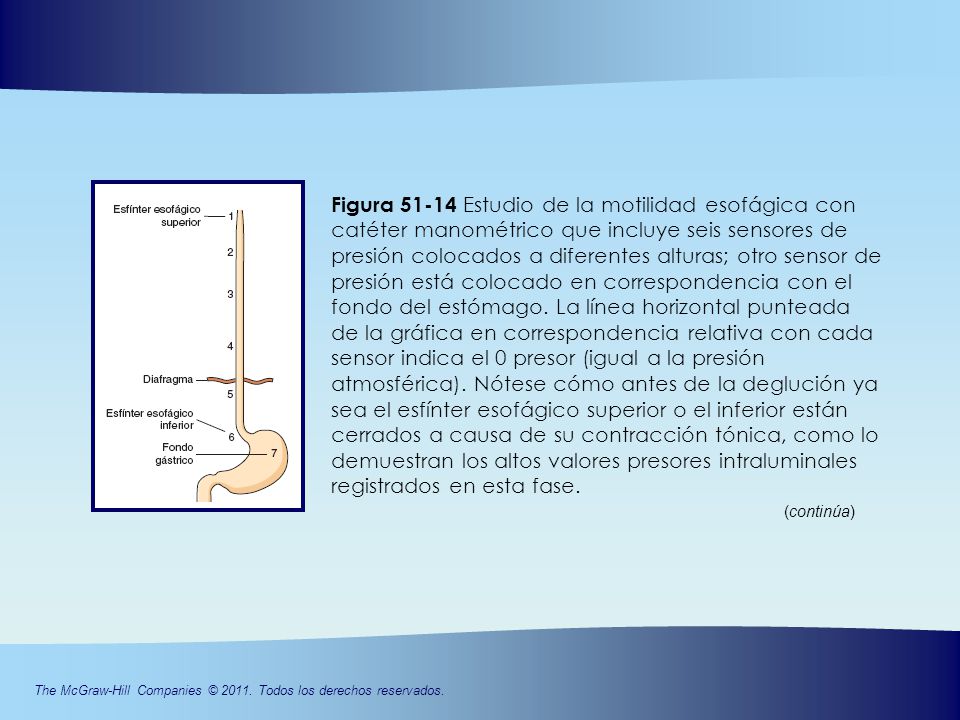 Figura Estudio de la motilidad esofágica con catéter manométrico que incluye seis sensores de presión colocados a diferentes alturas; otro sensor de presión está colocado en correspondencia con el fondo del estómago. La línea horizontal punteada de la gráfica en correspondencia relativa con cada sensor indica el 0 presor (igual a la presión atmosférica). Nótese cómo antes de la deglución ya sea el esfínter esofágico superior o el inferior están cerrados a causa de su contracción tónica, como lo demuestran los altos valores presores intraluminales registrados en esta fase.