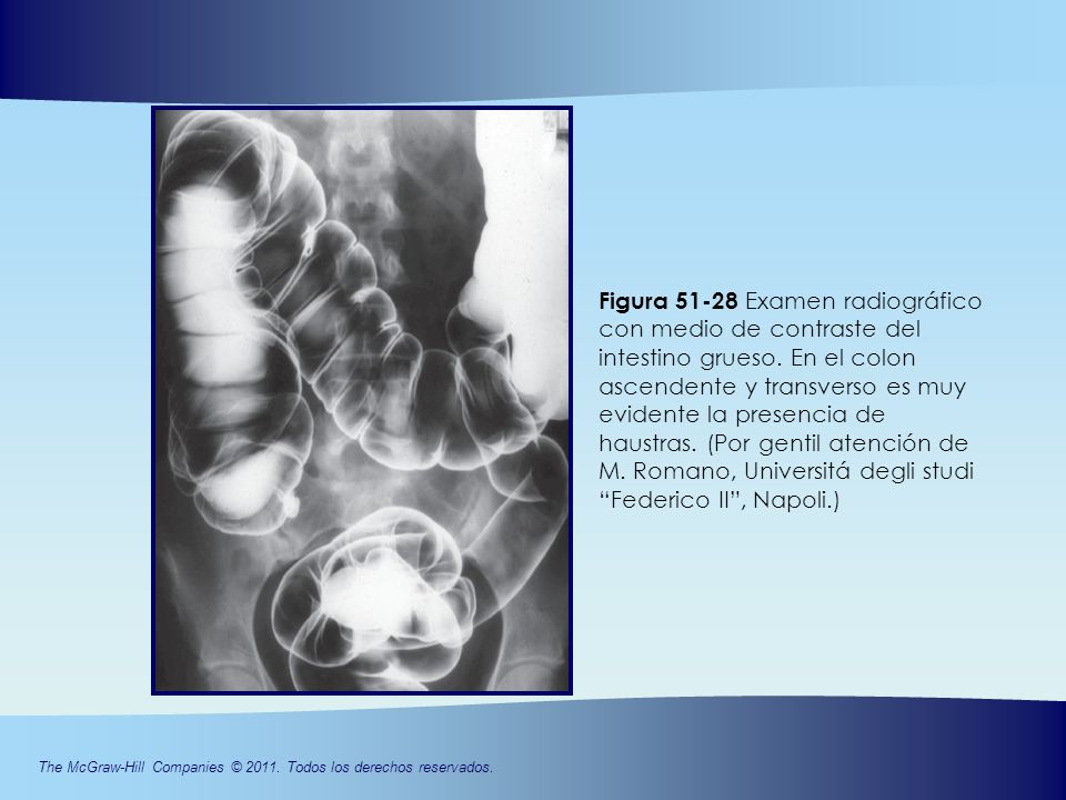 Figura Examen radiográfico con medio de contraste del intestino grueso. En el colon ascendente y transverso es muy evidente la presencia de haustras. (Por gentil atención de M. Romano, Universitá degli studi