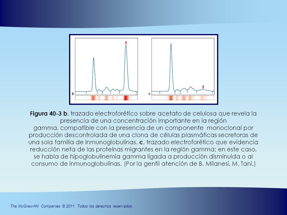 Figura 40-3 b, trazado electroforético sobre acetato de celulosa que revela la presencia de una concentración importante en la región