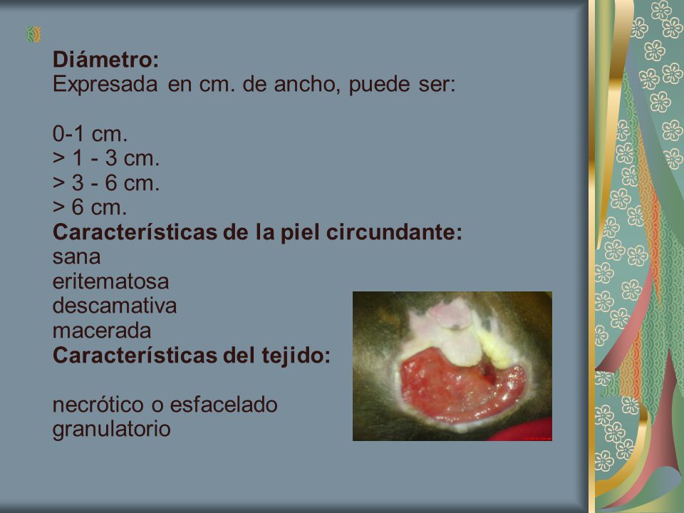 Diámetro: Expresada en cm. de ancho, puede ser: 0-1 cm. > cm