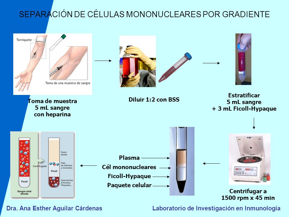 SEPARACIÓN DE CÉLULAS MONONUCLEARES POR GRADIENTE