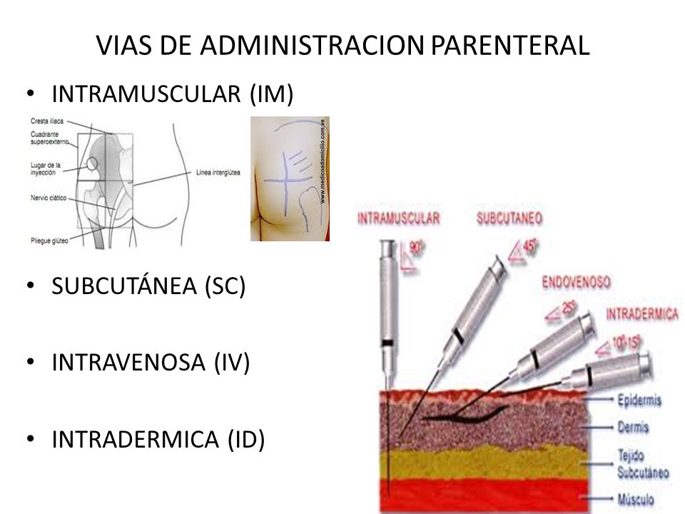 VIAS DE ADMINISTRACION PARENTERAL