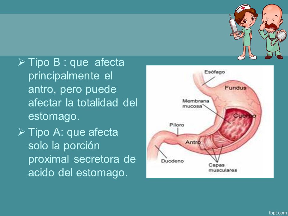 Tipo B : que afecta principalmente el antro, pero puede afectar la totalidad del estomago.