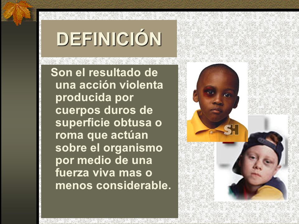 DEFINICIÓN