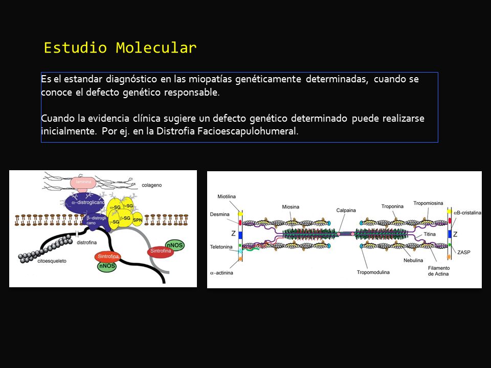 Estudio Molecular Es el estandar diagnóstico en las miopatías genéticamente determinadas, cuando se conoce el defecto genético responsable.