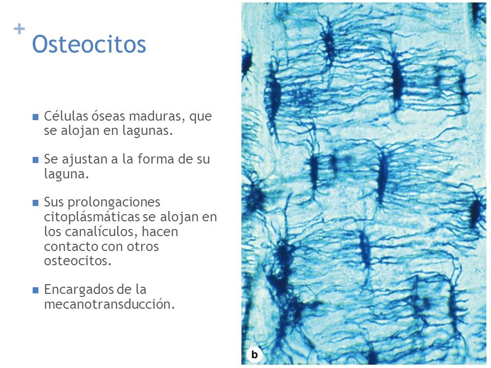 Osteocitos Células óseas maduras, que se alojan en lagunas.