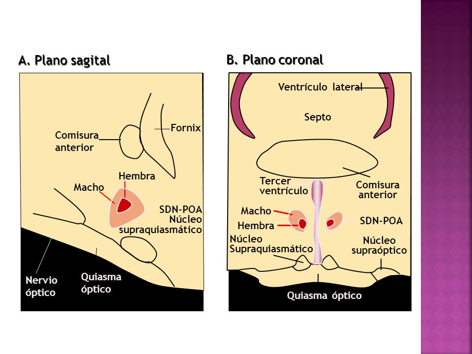 A. Plano sagital B. Plano coronal Ventrículo lateral Septo Fornix