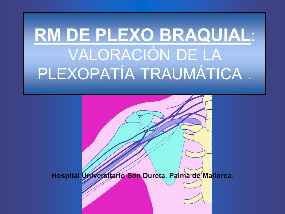RM DE PLEXO BRAQUIAL: VALORACIÓN DE LA PLEXOPATÍA TRAUMÁTICA .