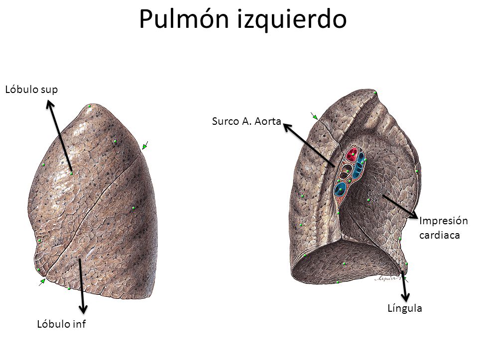 Pulmón izquierdo Lóbulo sup Surco A. Aorta Impresión cardiaca Língula