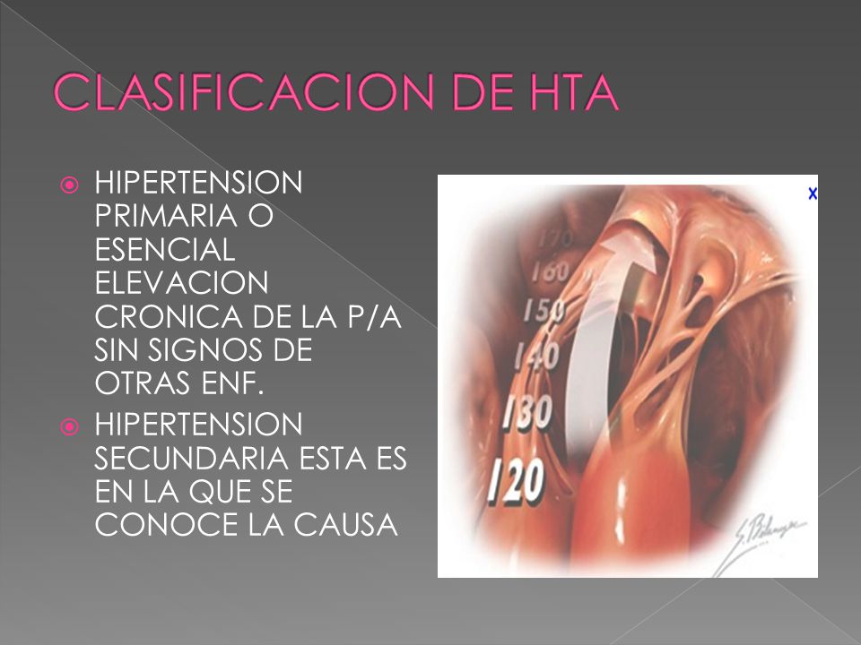 CLASIFICACION DE HTA HIPERTENSION PRIMARIA O ESENCIAL ELEVACION CRONICA DE LA P/A SIN SIGNOS DE OTRAS ENF.