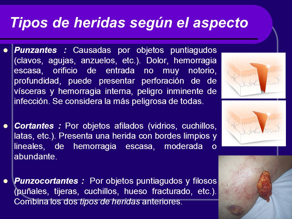 Tipos de heridas según el aspecto