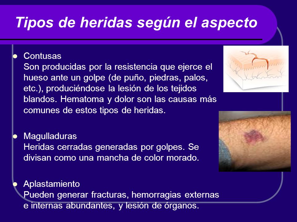 Tipos de heridas según el aspecto