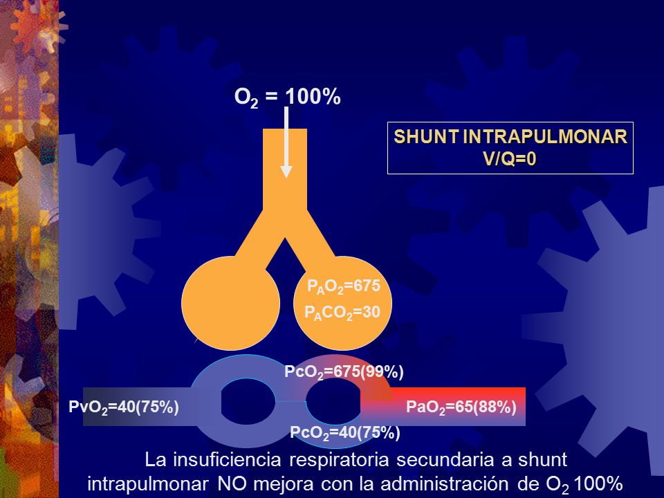 O2 = 100% SHUNT INTRAPULMONAR. V/Q=0. PAO2=675. PACO2=30. PcO2=675(99%) PvO2=40(75%) PaO2=65(88%)