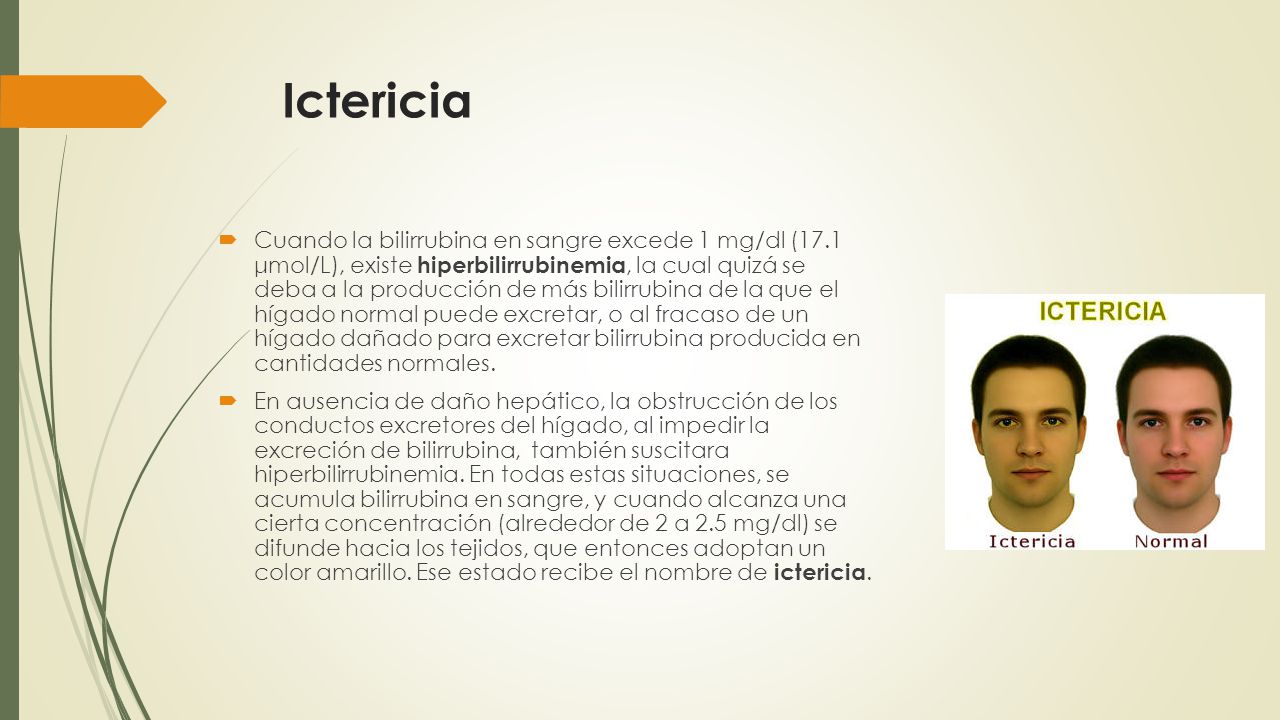 Ictericia