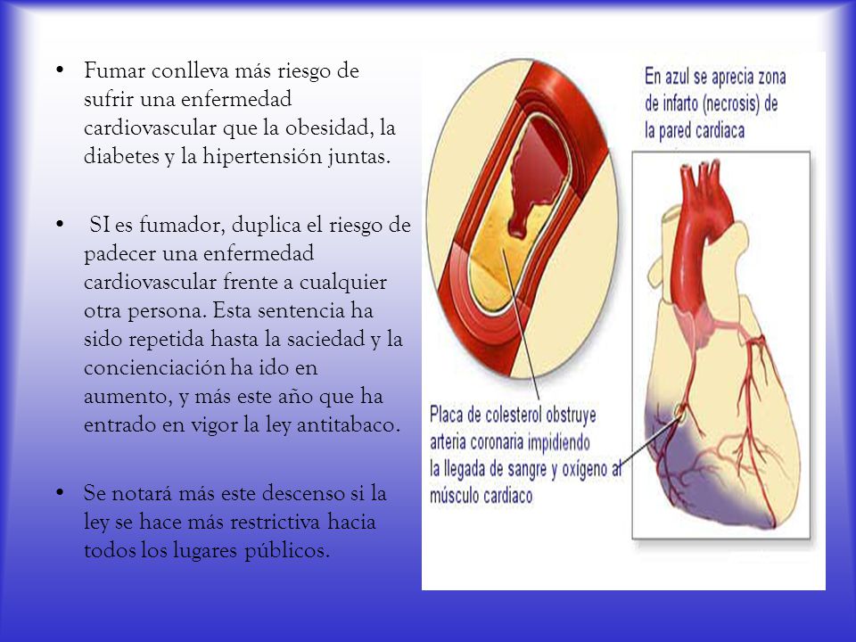 Fumar conlleva más riesgo de sufrir una enfermedad cardiovascular que la obesidad, la diabetes y la hipertensión juntas.