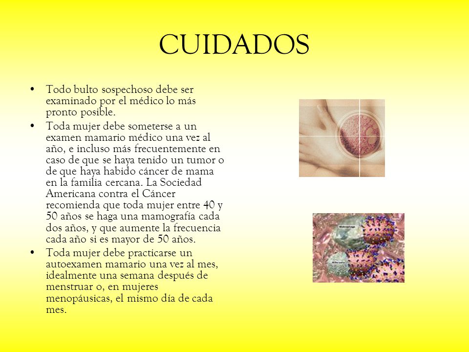 CUIDADOS Todo bulto sospechoso debe ser examinado por el médico lo más pronto posible.