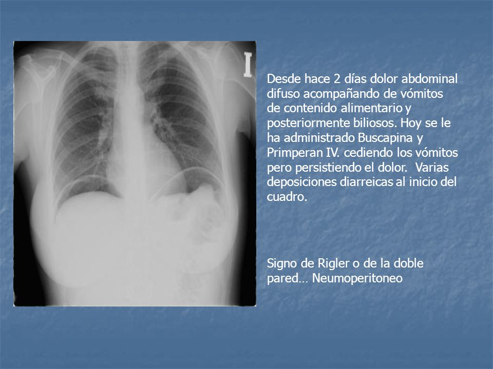 Desde hace 2 días dolor abdominal difuso acompañando de vómitos de contenido alimentario y posteriormente biliosos. Hoy se le ha administrado Buscapina y Primperan IV. cediendo los vómitos pero persistiendo el dolor. Varias deposiciones diarreicas al inicio del cuadro.