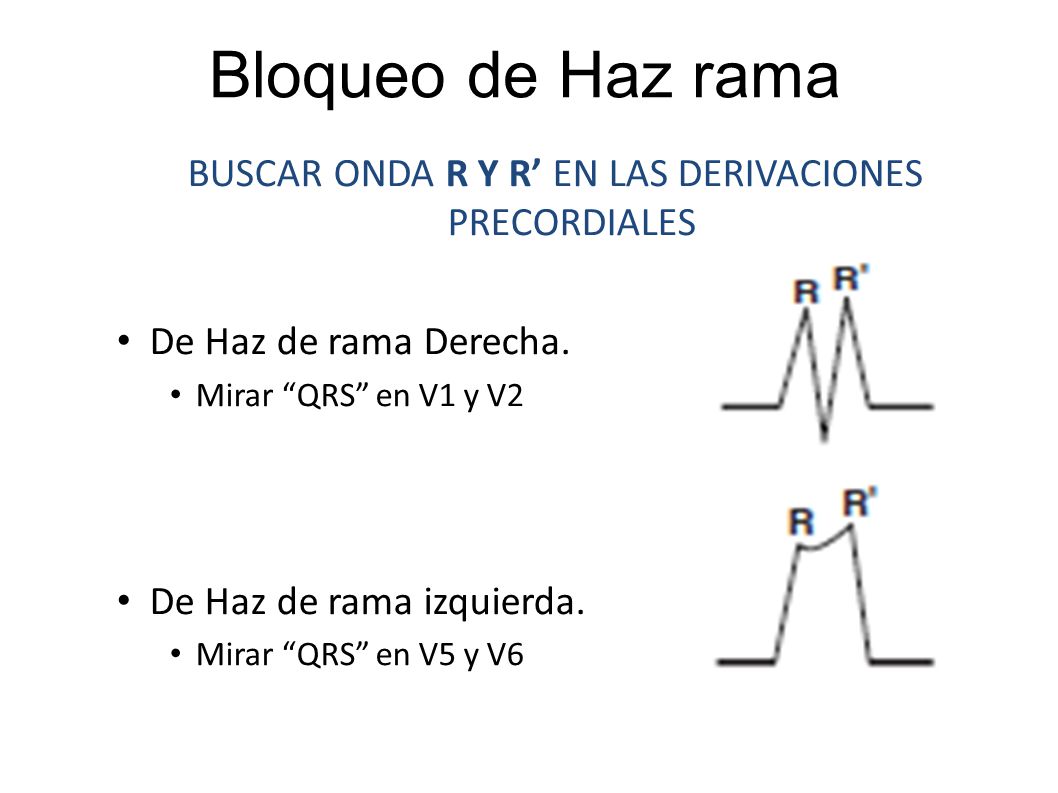 BUSCAR ONDA R Y R’ EN LAS DERIVACIONES PRECORDIALES