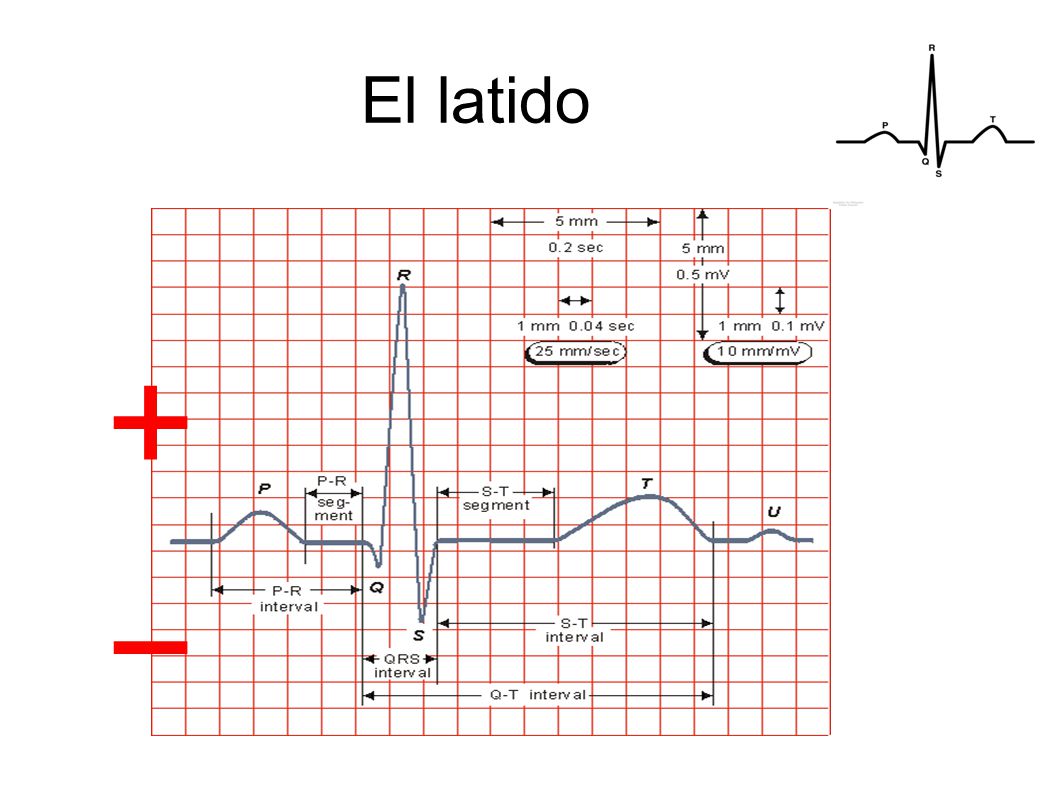 El latido