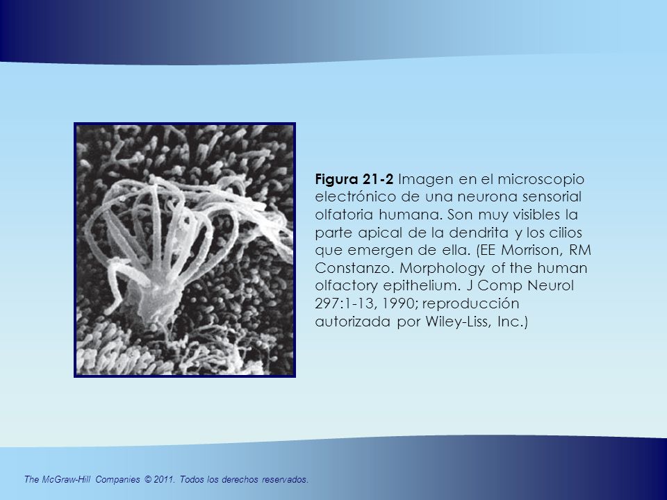 Figura 21-2 Imagen en el microscopio electrónico de una neurona sensorial